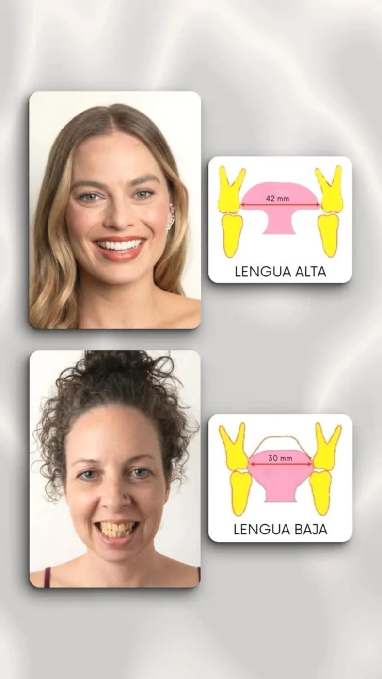 Conexión paladar y altura de la lengua